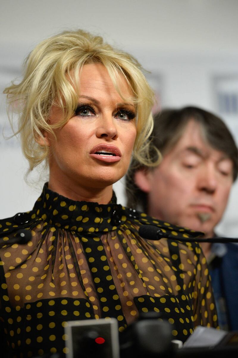 Pamela Anderson contro il foie gras 31
