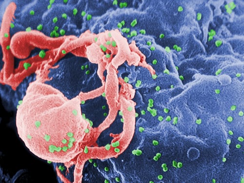 Dopo dodici anni senza terapie vede regredire il virus dell’Aids