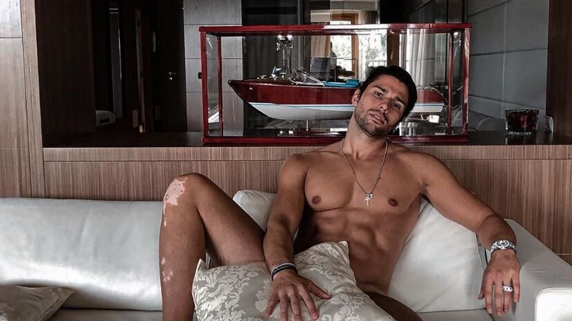 Luca Onestini sfida la censura e posa nudo con i segni della psoriasi