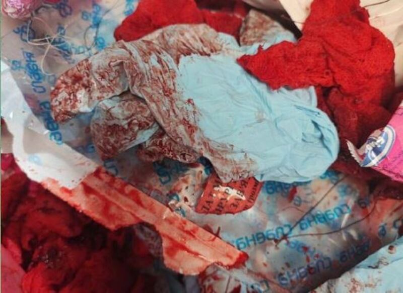 Le foto choc dall'ospedale dell'acciaieria Azovstal 3