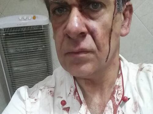 Napoli, accoltella ladro in pizzeria poi pubblica le foto su Facebook