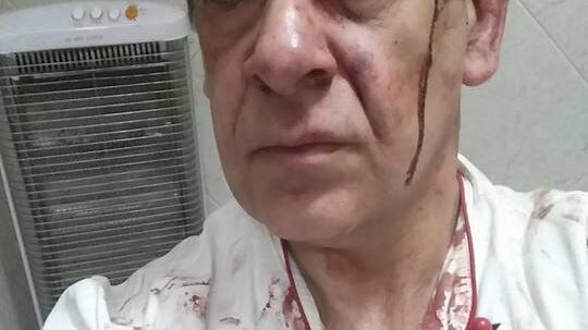 Napoli, accoltella ladro in pizzeria poi pubblica le foto su Facebook