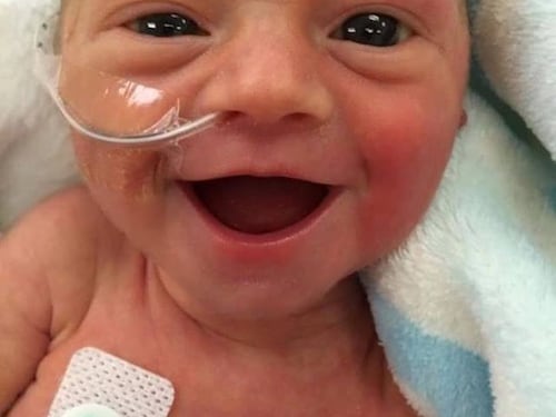 La foto di questa bimba nata prematura è diventata virale: "Lei è felice"