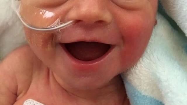 La foto di questa bimba nata prematura è diventata virale: "Lei è felice"