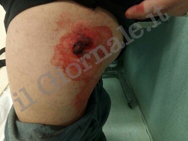 Le foto choc del poliziotto ferito da un bullone 2