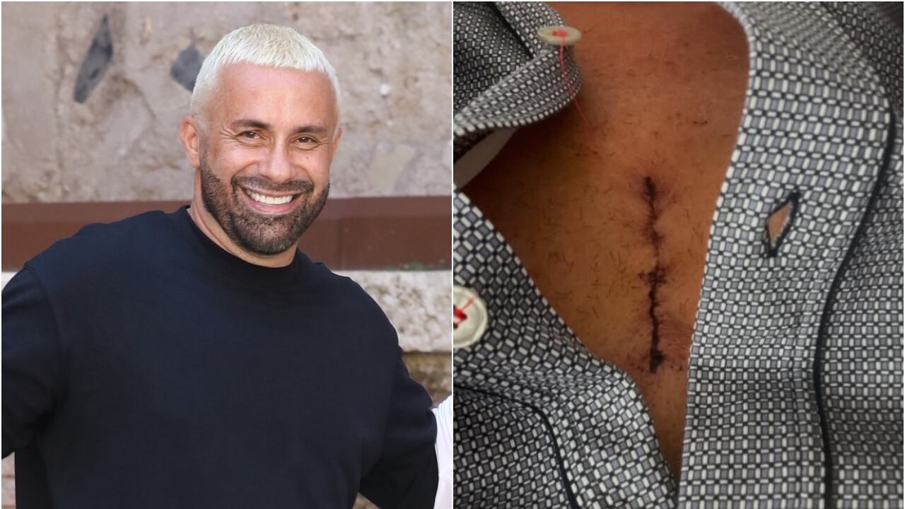 Luca Tommassini operato al cuore, il messaggio sui social: "Più impegnativo di quello che mi aspettavo"