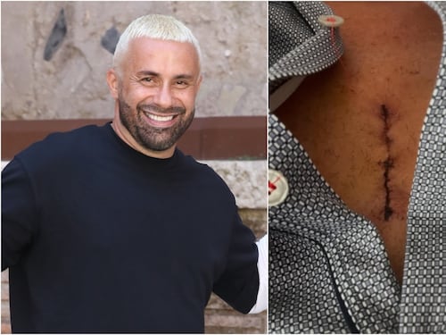 Luca Tommassini operato al cuore, il messaggio sui social: "Più impegnativo di quello che mi aspettavo"