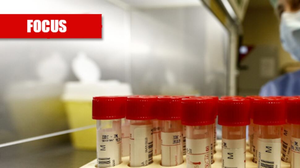 Covid-19 naturale o da laboratorio? Il mistero che divide gli esperti
