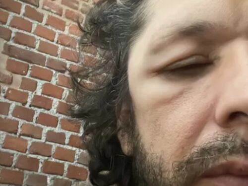Ermal Meta preoccupa i fan: "Mi si gonfiano parti del viso e della testa"