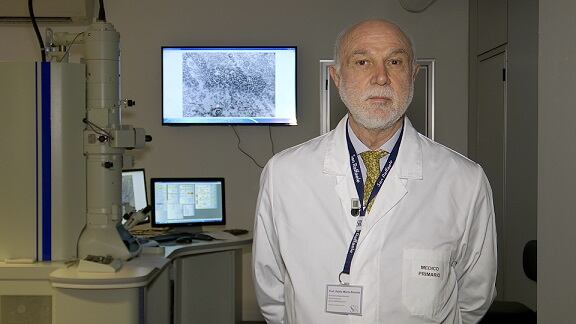 Lotta all'Alzheimer con gli ultrasuoni