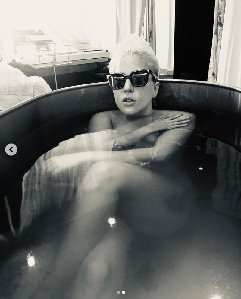 Lady Gaga, le foto sexy 4
