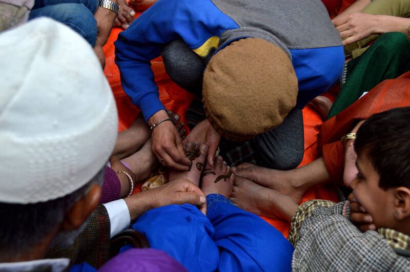La terapia delle sanguisughe nel Kashmir indiano 7