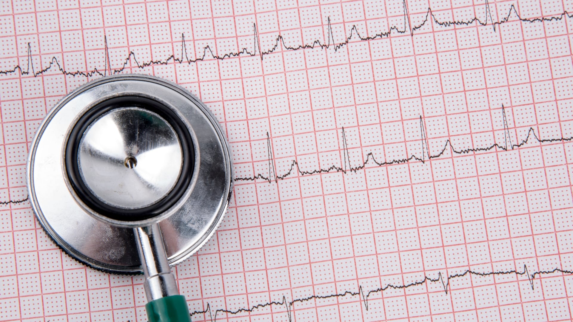 Endocardite, i sintomi da non sottovalutare