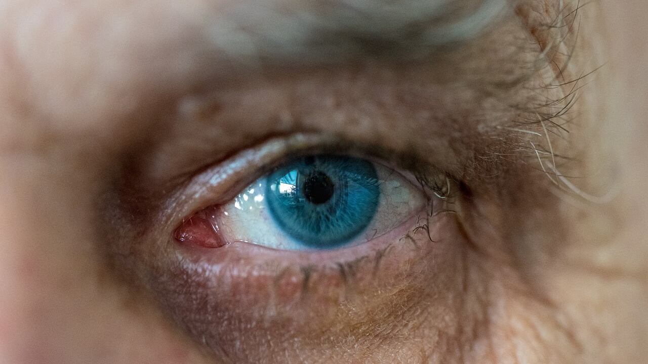 Over e maculopatia: l’importanza degli antiossidanti
