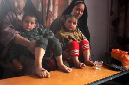 La terapia delle sanguisughe nel Kashmir indiano 8