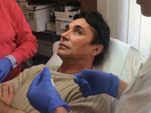 Scialpi e il "ritocchino": "Mi hanno tolto cinque anni"