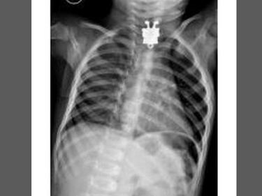 Pazze radiografie: gli oggetti che possono finire nel corpo umano 1