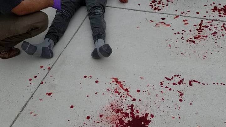 Ragazzo disabile picchiato dai bulli, la mamma pubblica le foto su Fb