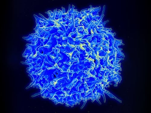 Tumore, la nuova cellula T come terapia universale