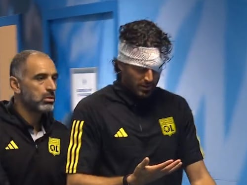 Lancio di sassi, ferito Grosso prima del match con Gattuso