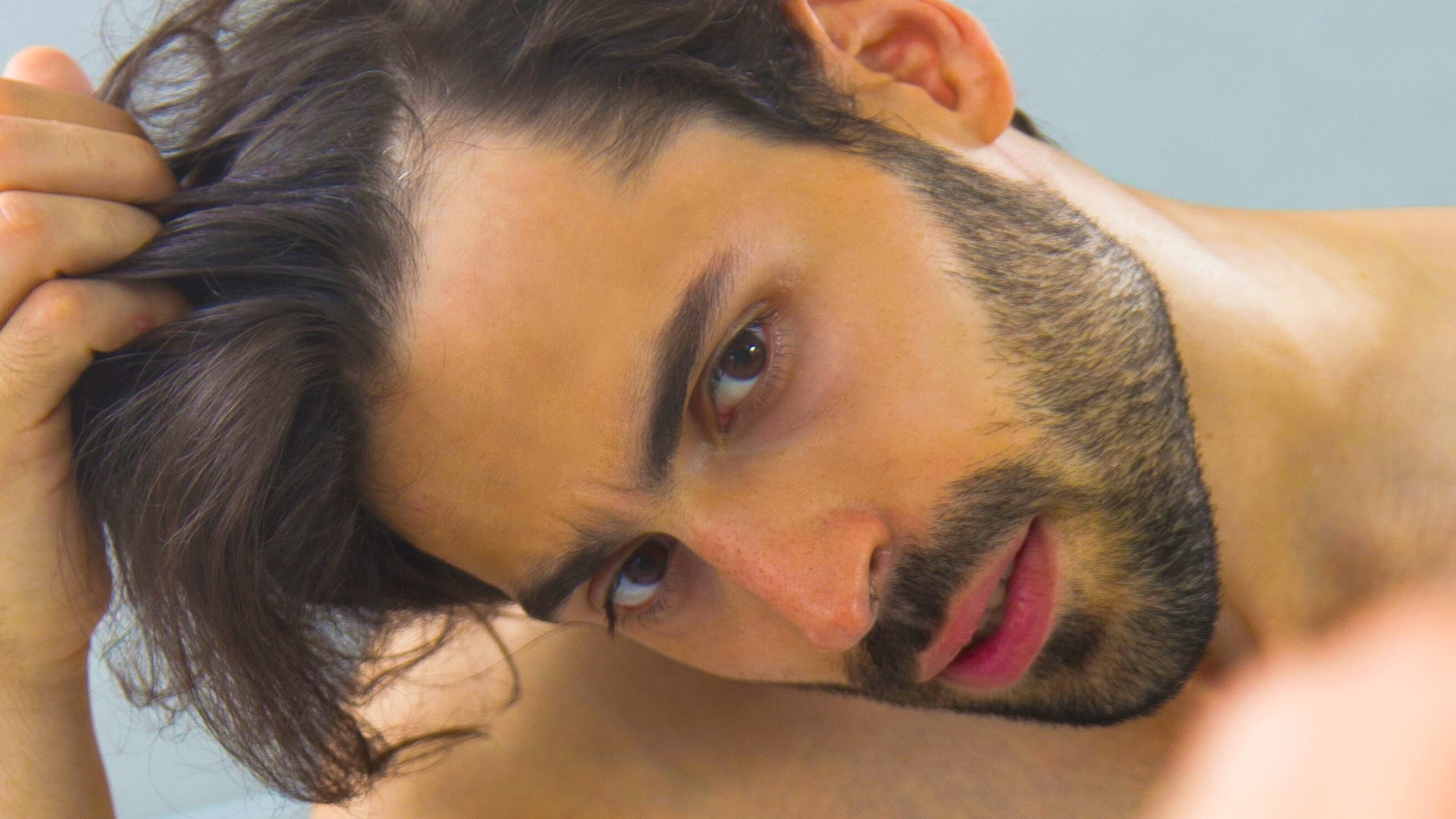 Rigenerazione dei Capelli, la Calvizie si cura senza chirurgia
