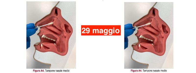 Tampone rinofaringeo 2