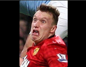 Rooney pubblica le foto del suo infortunio e sul web scatta la satira 1
