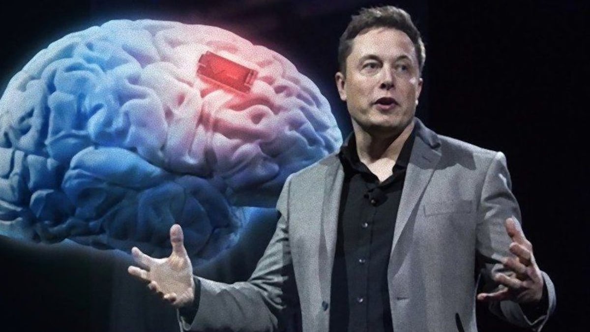 Il chip nel nostro cervello