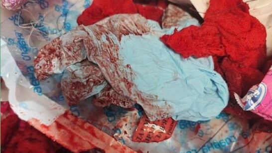 L'orrore nell'ospedale dell'acciaieria Azovstal di Mariupol