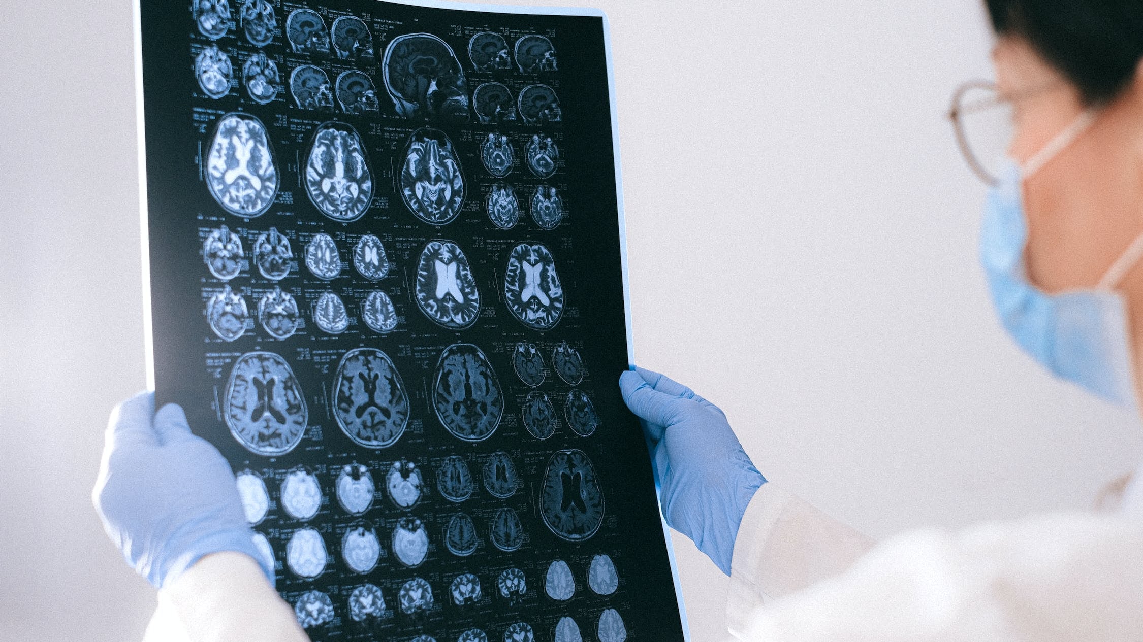 Alzheimer e Parkinson, trovate le spie: la scoperta che cambia tutto