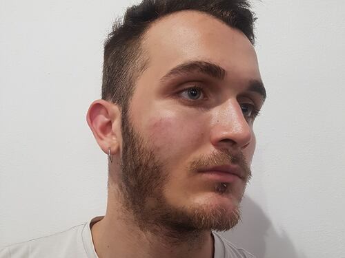 Como, giovane picchiato perché gay: "Sei solo un fr...o"