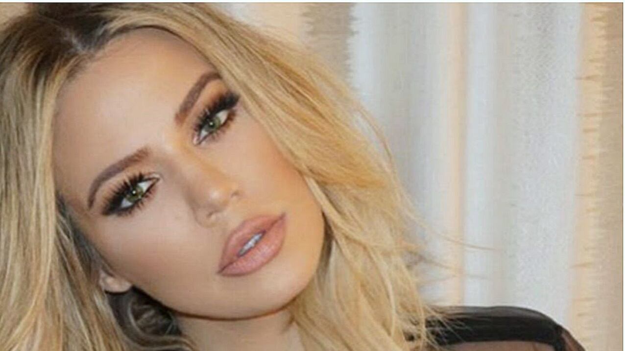 Khloe Kardashian rinuncia ai filler per le labbra per uscire solo con uomini bianchi