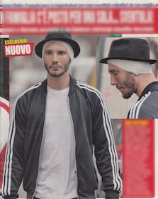 Stefano De Martino cede al ritocchino: si è rifatto le orecchie 4