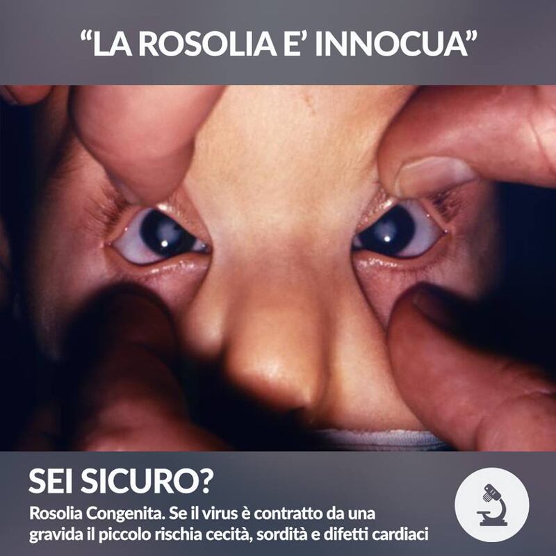 Vaccini, le foto choc: cosa succede a chi non si vaccina 5