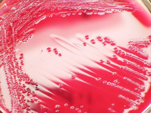 Shigella, il batterio responsabile della dissenteria