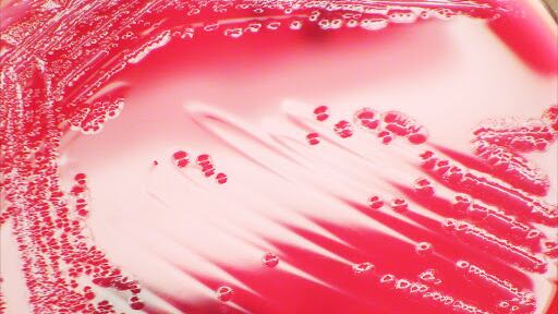 Shigella, il batterio responsabile della dissenteria