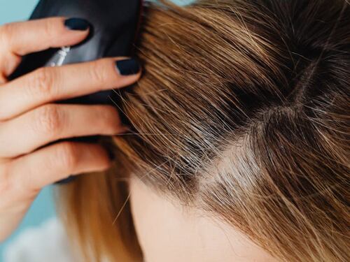 Perdita di capelli femminile: cosa sapere sull’effluvio da menopausa