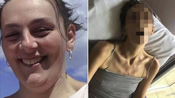Muore in pochi mesi per un tumore al collo dell'utero. Il dramma per un pap test mancato