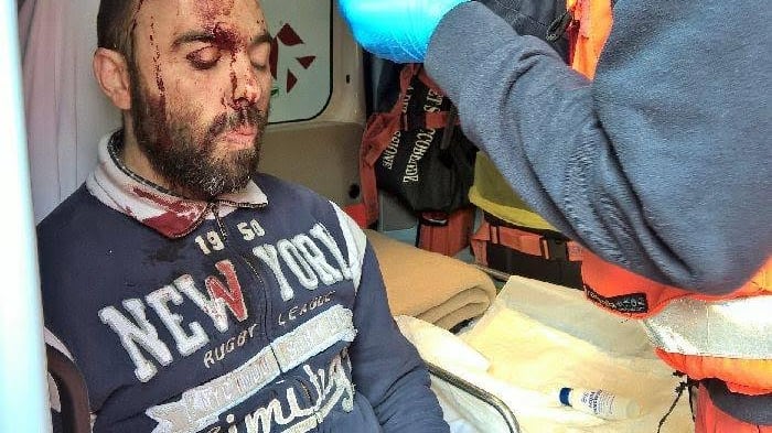 Raccolgono cibo per italiani poveri: bastonati da anarchici e immigrati