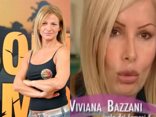 Così la Bazzani ha perso la vista: "Colluttazione con un clandestino"