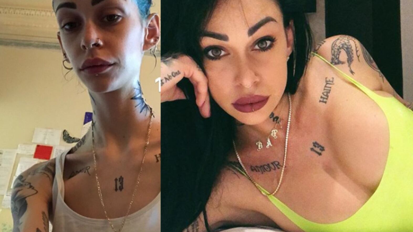 Uomini e donne, Valentina Dallari e l'anoressia: "Un anno fa mi vedevo sana"