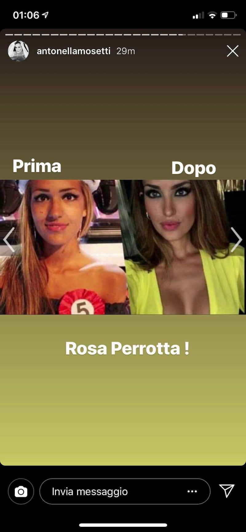 Antonella Mosetti dimostra i ritocchini estetici di Giulia De Lellis e Rosa Perr