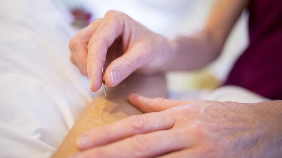 Agopuntura, come funziona e perché è fonte di benessere