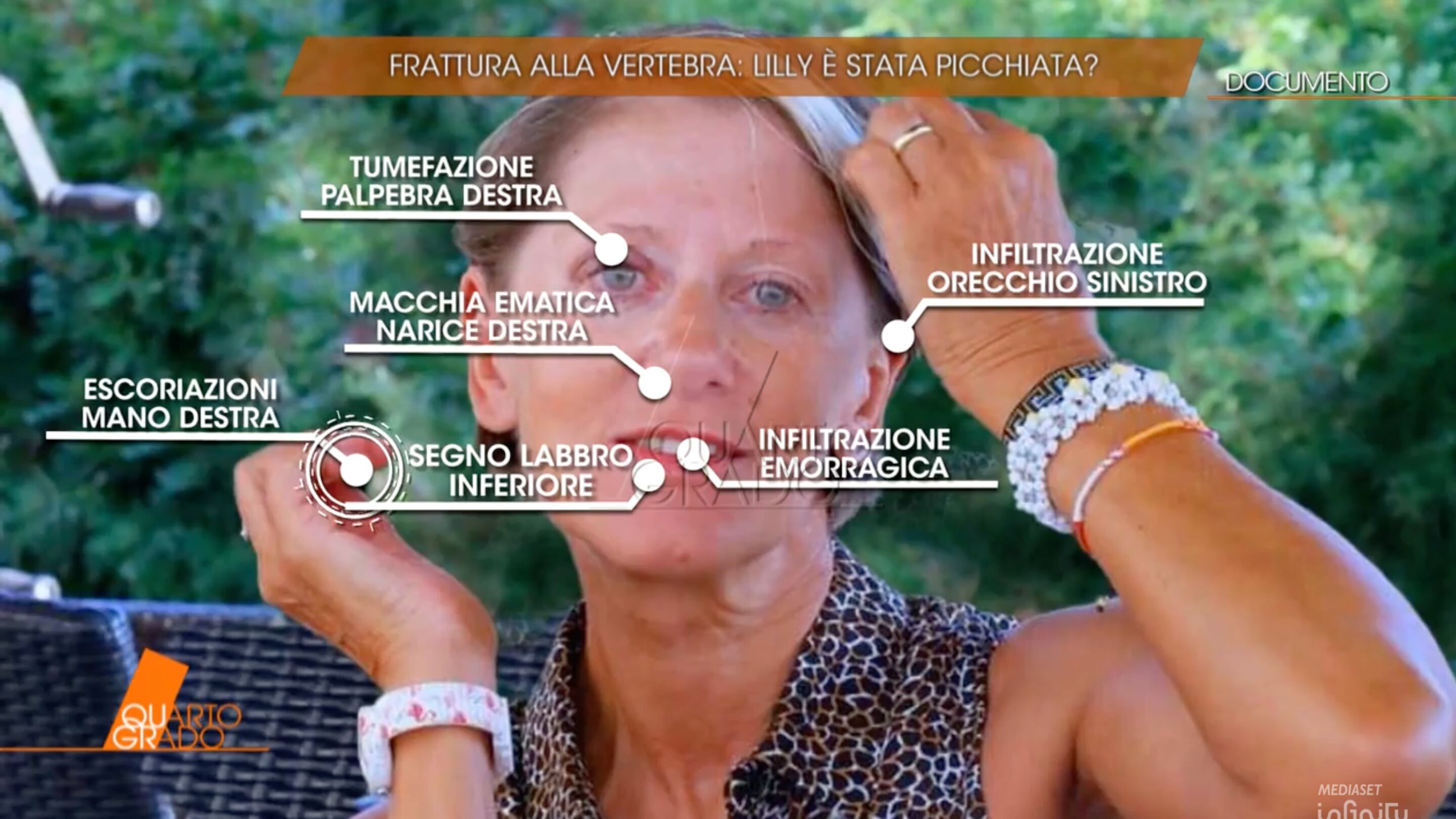 Giallo Resinovich: “Un'azione di terzi sul corpo di Lilly”