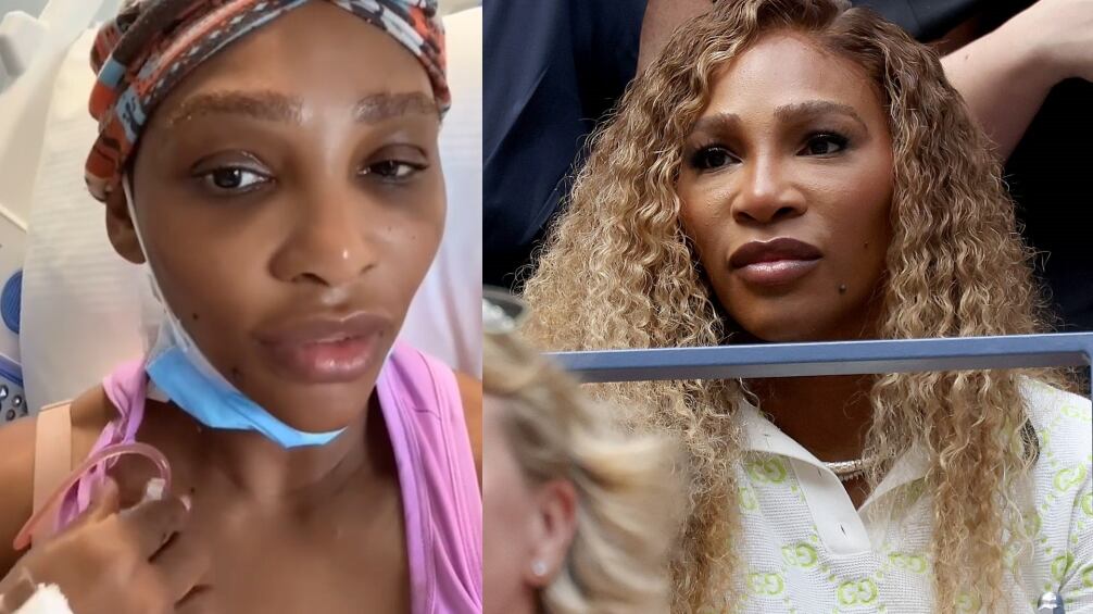 Serena Williams, il dramma sui social: "Operata per una cisti branchiale grande come un pompelmo"