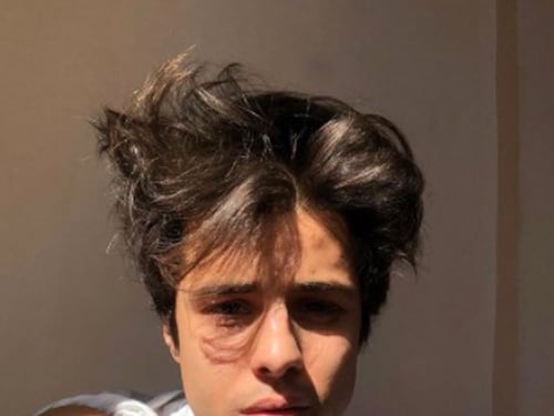 Violata la tomba di Michele Merlo, la rabbia del padre: "Gesto grave"