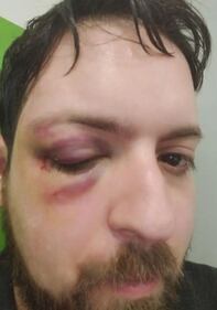 Matthia Pezzoni aggredito dalle borseggiatrici in metropolitana 2