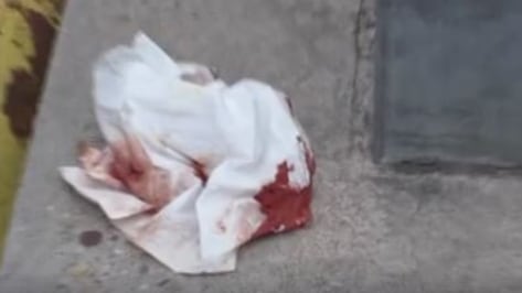 Migrante pesta anziano: si era masturbato di fronte all'asilo