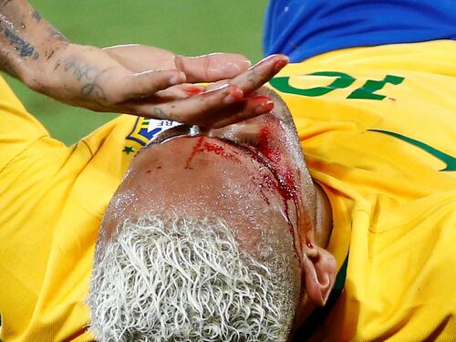 Neymar trascina il Brasile contro la Bolivia e va ko per una gomitata