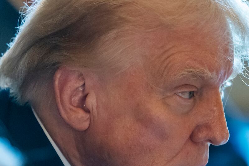 Donald Trump senza benda2
